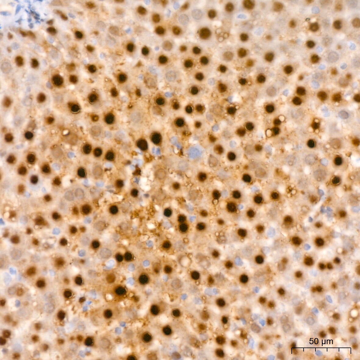 ABH1 Antibody (5K4W5)