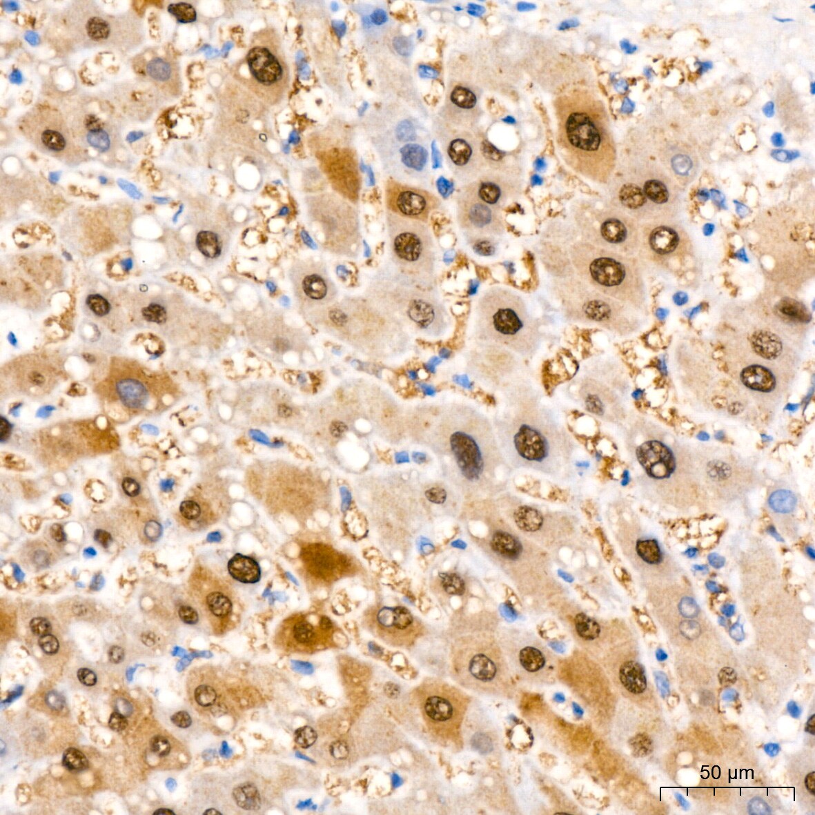 ABH1 Antibody (5K4W5)