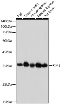 PIM2 Antibody (3V1S5)