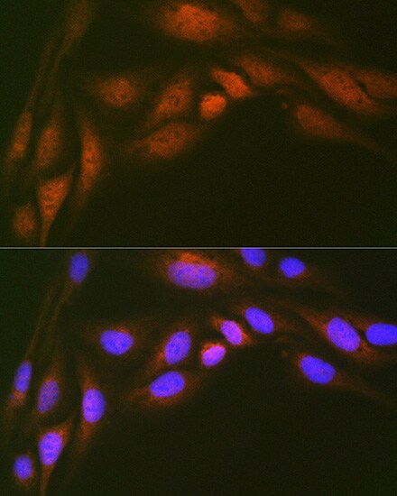 UBE2N/Ubc13 Antibody (10O9Z5)