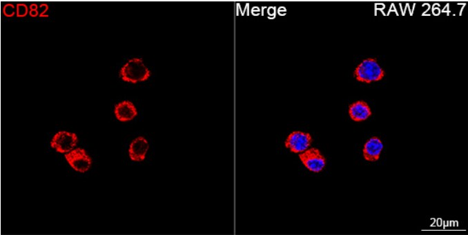 CD82/Kai-1 Antibody (0T3L6)
