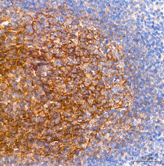 CD82/Kai-1 Antibody (0T3L6)