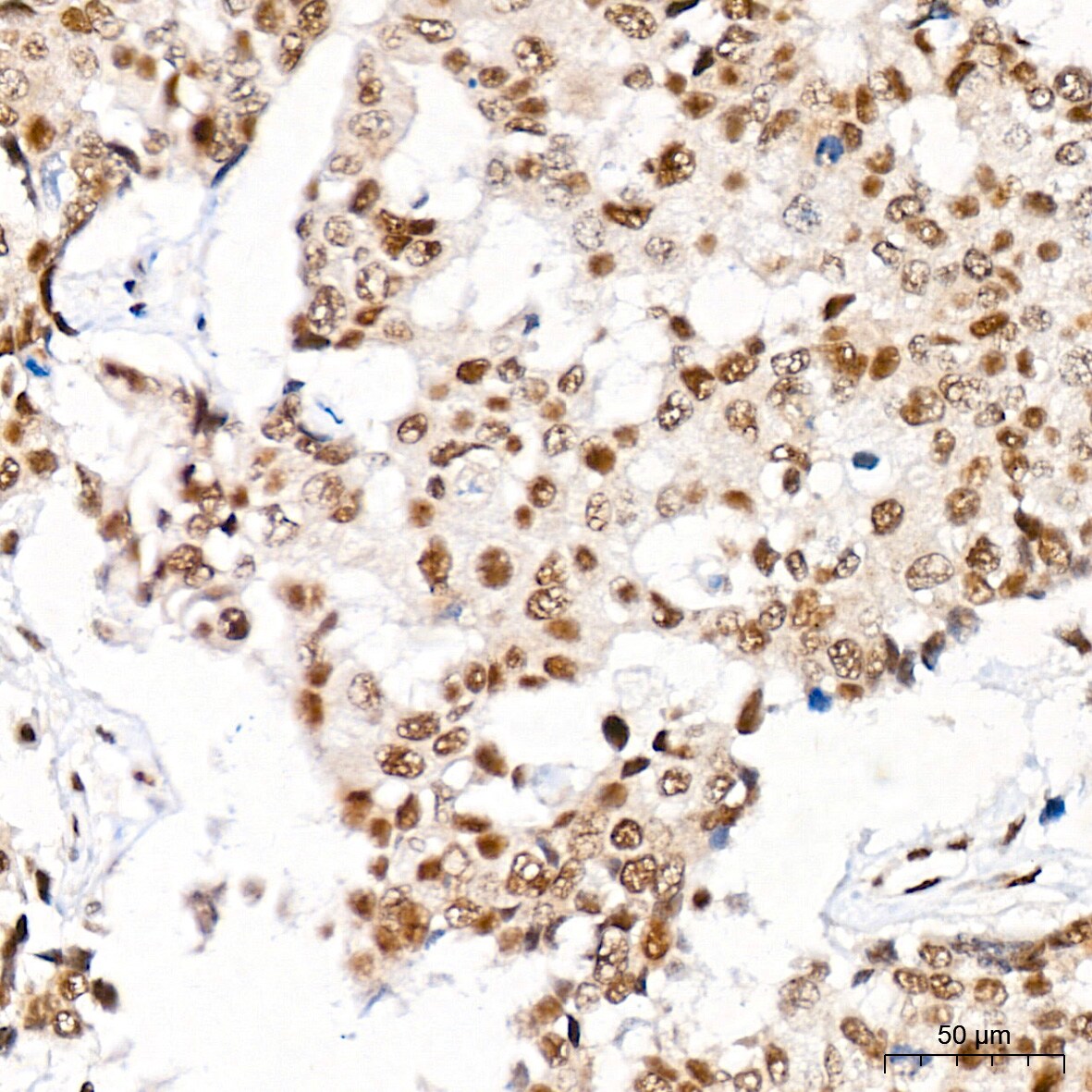 CaMKIV Antibody (1G4P4)