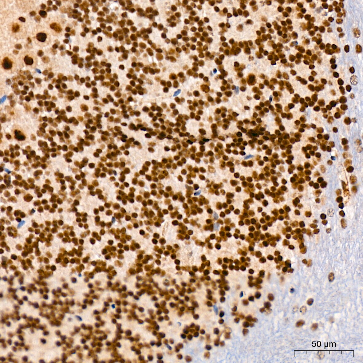 CaMKIV Antibody (1G4P4)