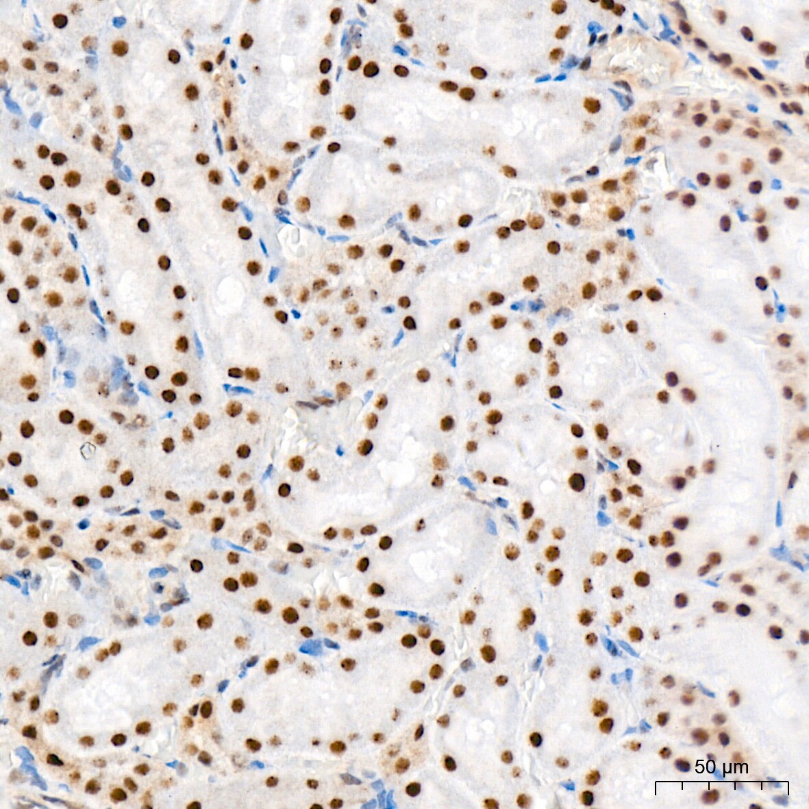 CaMKIV Antibody (1G4P4)