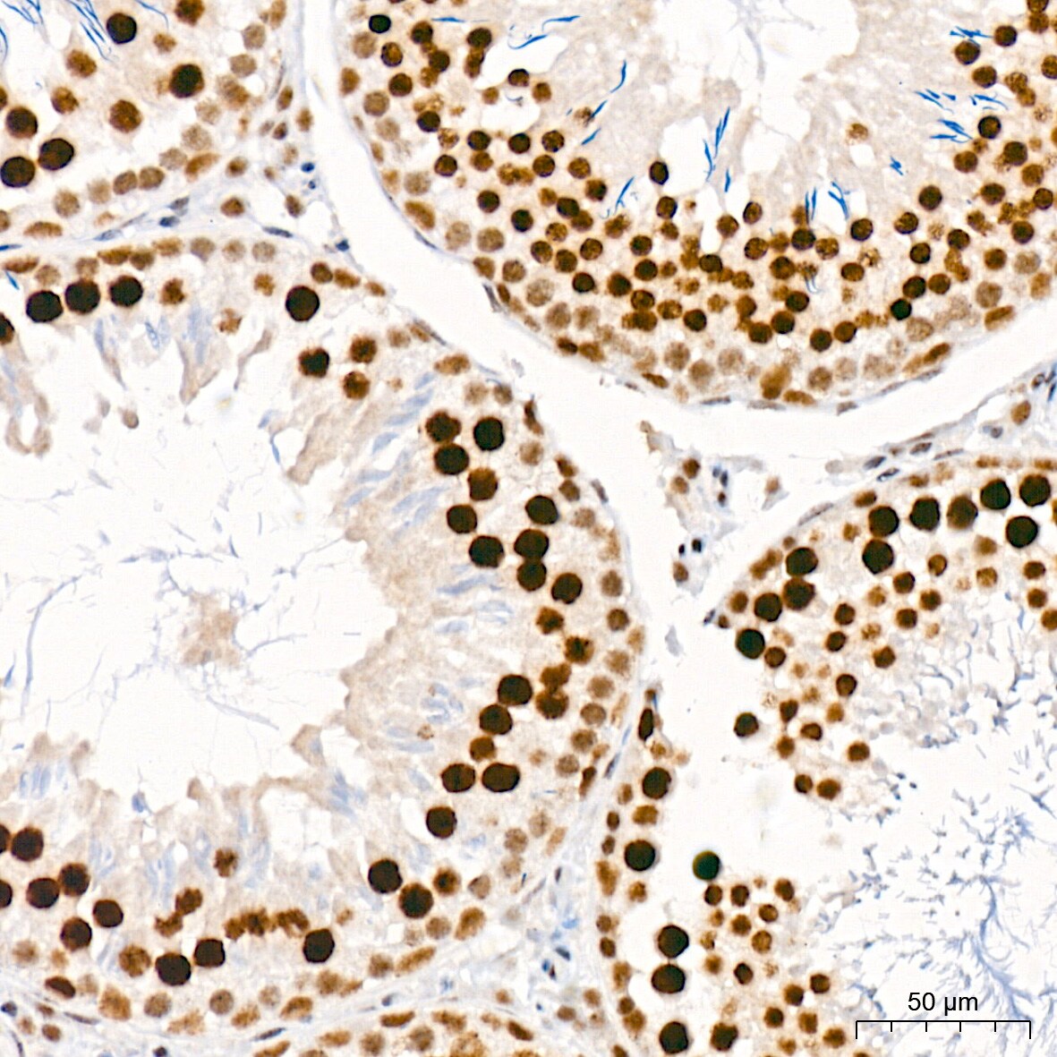 CaMKIV Antibody (1G4P4)