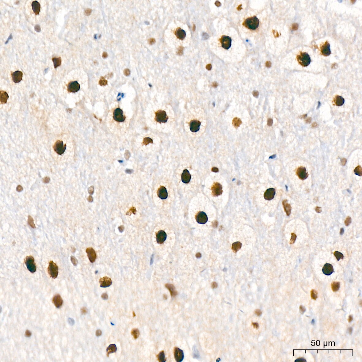 CaMKIV Antibody (1G4P4)