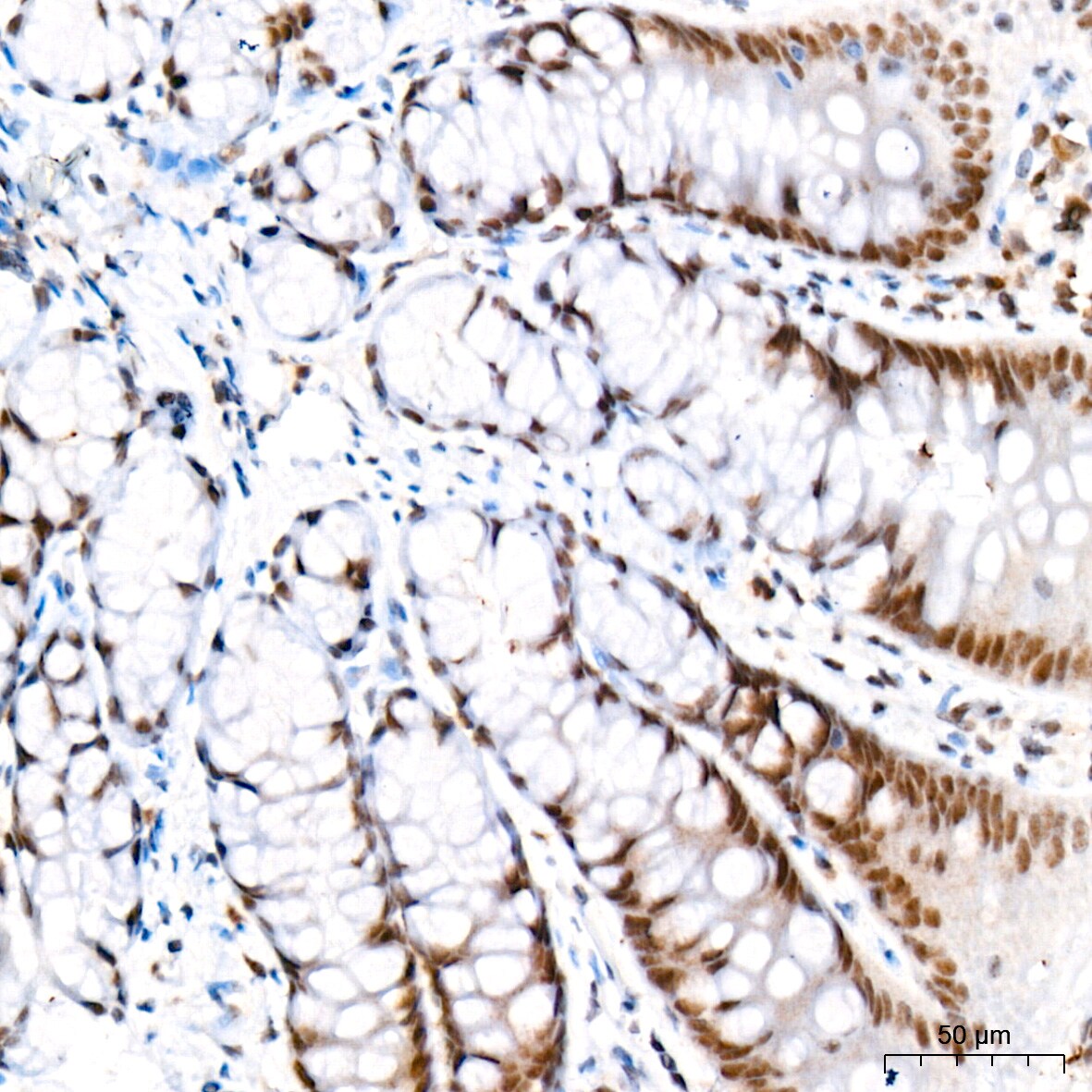 CaMKIV Antibody (1G4P4)
