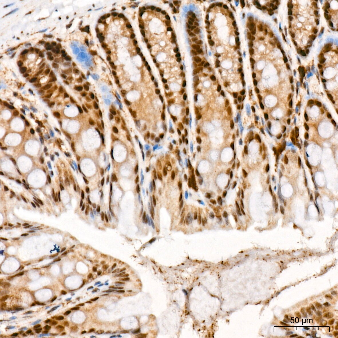 CaMKIV Antibody (1G4P4)