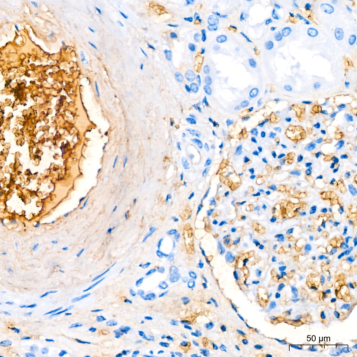 Hemoglobin A1 Antibody (1R1N7)