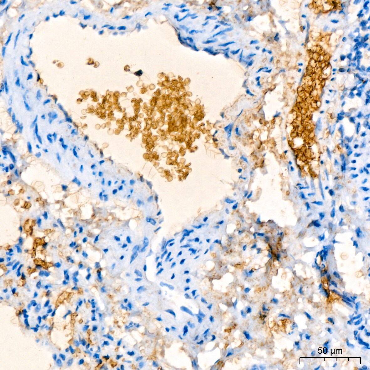 Hemoglobin A1 Antibody (1R1N7)