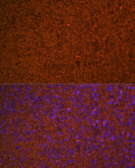 Hemoglobin A1 Antibody (1R1N7)