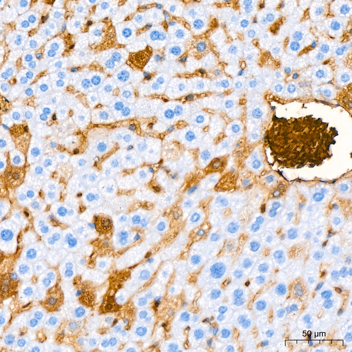 Hemoglobin A1 Antibody (1R1N7)