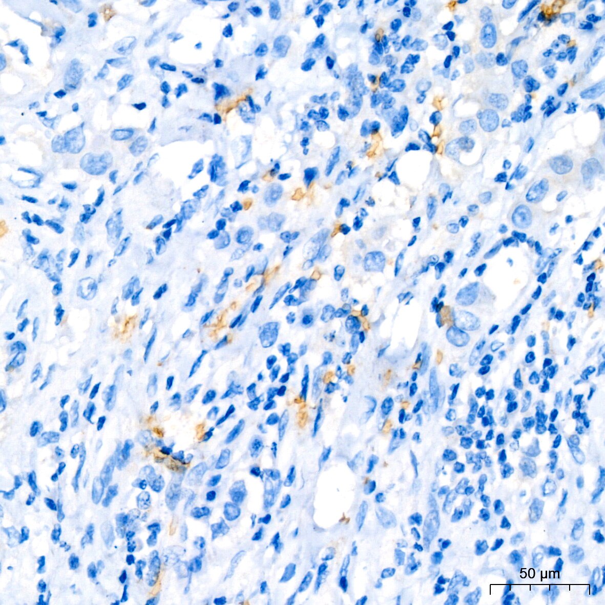 Hemoglobin A1 Antibody (1R1N7)