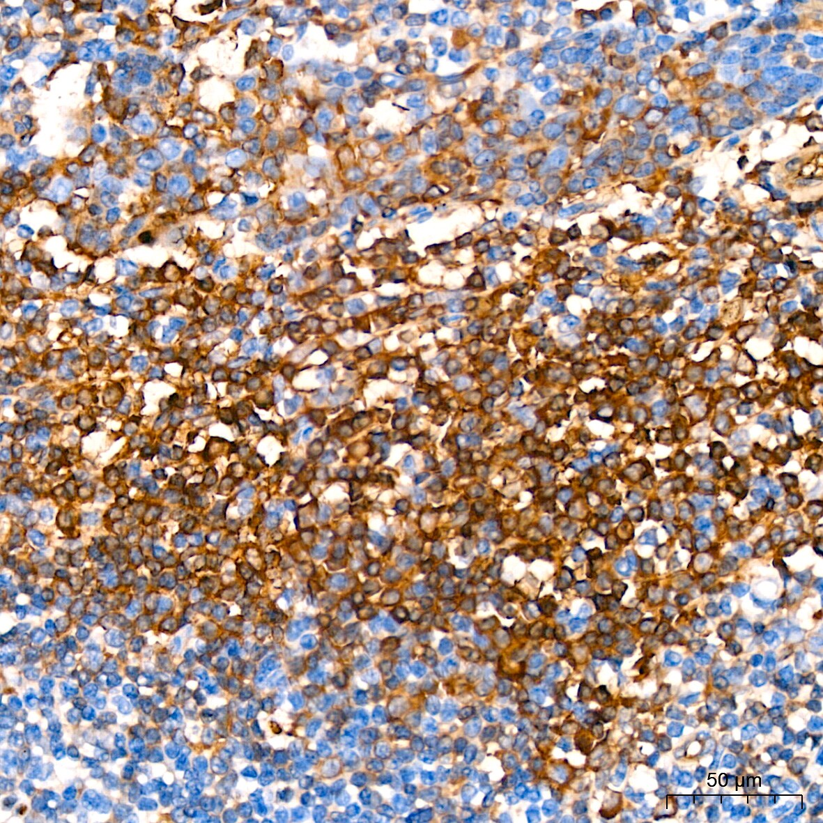 Hemoglobin A1 Antibody (1R1N7)
