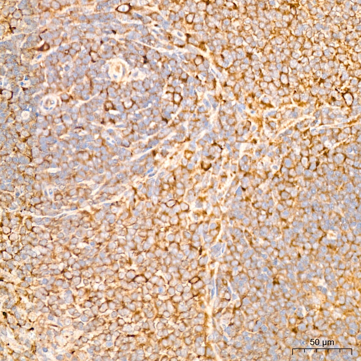 IL-11R alpha Antibody (10Z3S9)