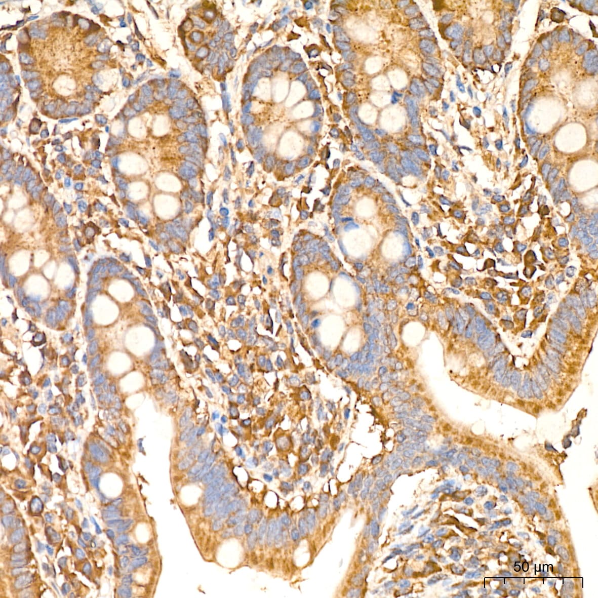 IL-11R alpha Antibody (10Z3S9)