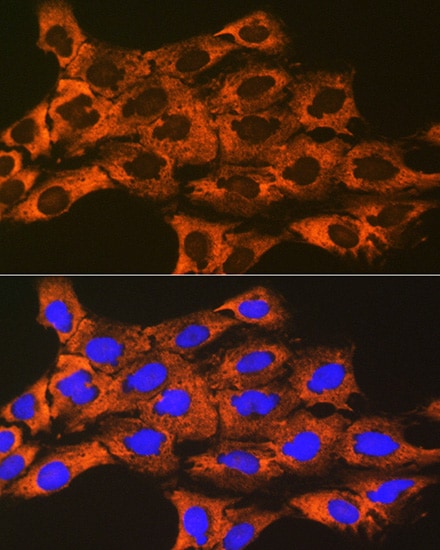UQCRFS1 Antibody (0O9Z10)