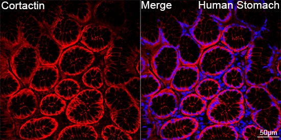 Cortactin Antibody (2W5H9)
