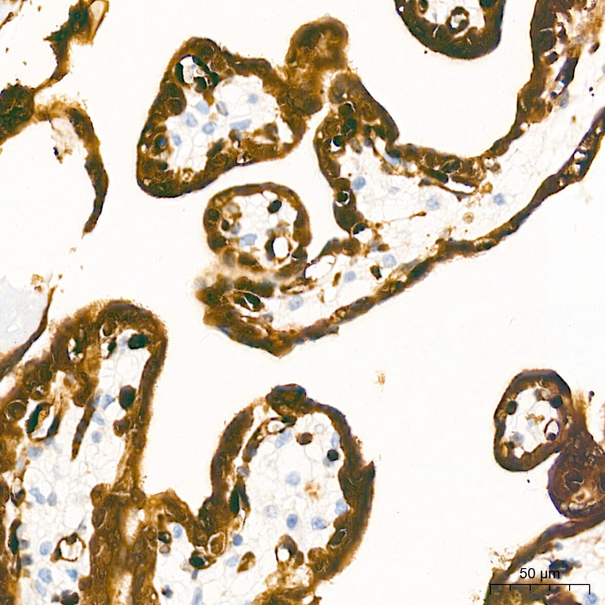 LIN-28B Antibody (7D7F7)