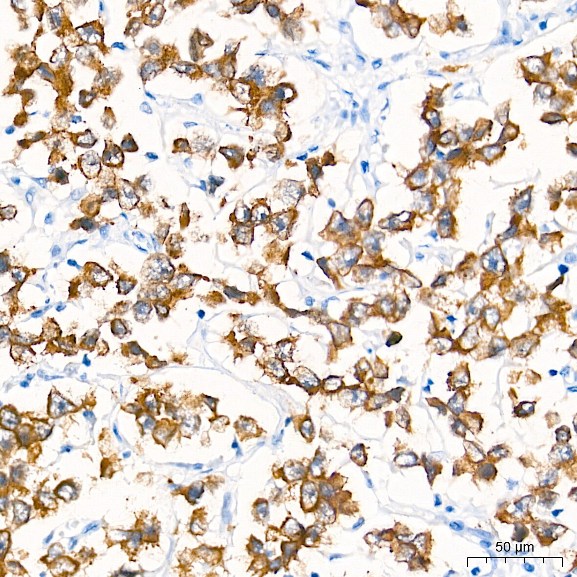 LIN-28B Antibody (7D7F7)