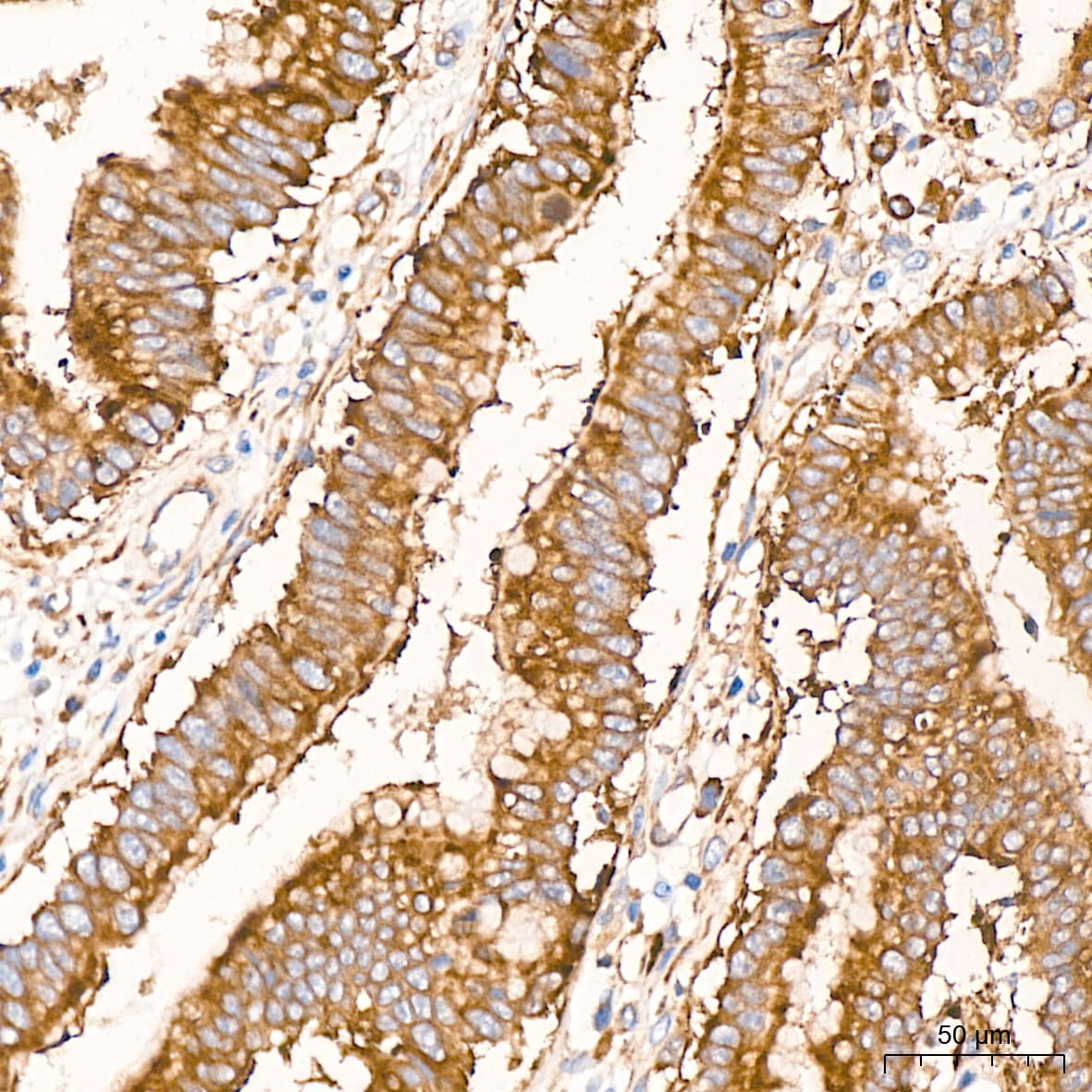 RPS20 Antibody (9H1D4)