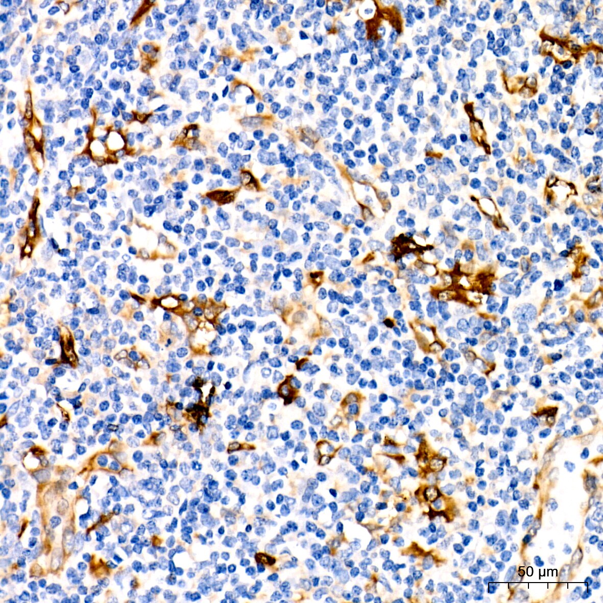 Fascin Antibody (1B3V6)