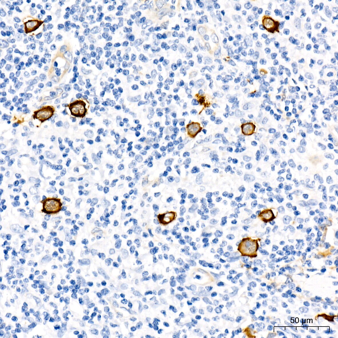 Fascin Antibody (1B3V6)