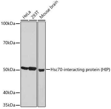 Hsp70 interacting protein HIP Antibody (4A3G8)