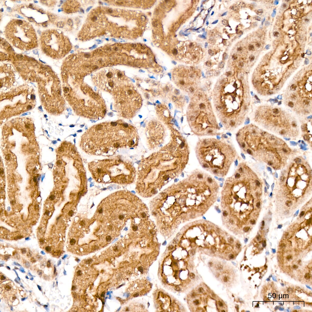 PSMD14 Antibody (5V0H3)