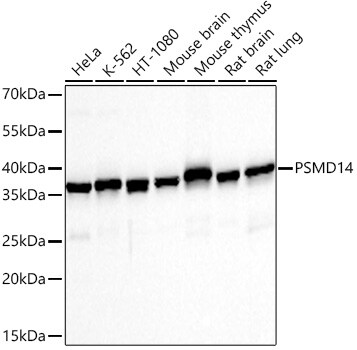 PSMD14 Antibody (5V0H3)