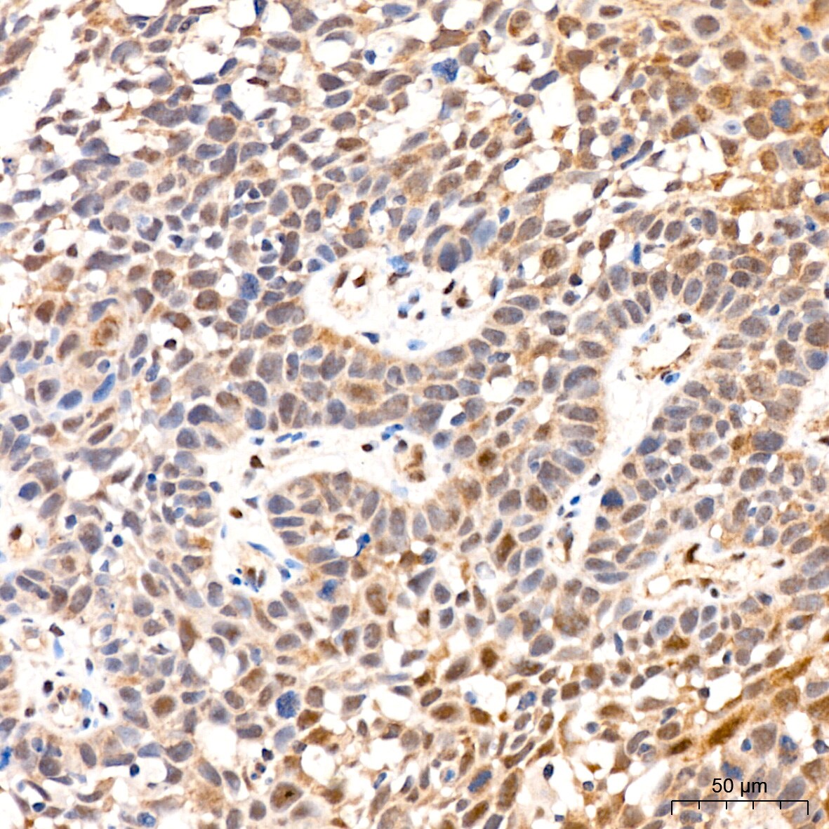 PSMD14 Antibody (5V0H3)