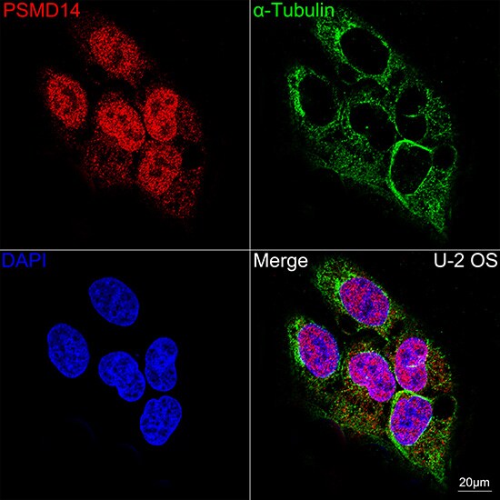 PSMD14 Antibody (5V0H3)