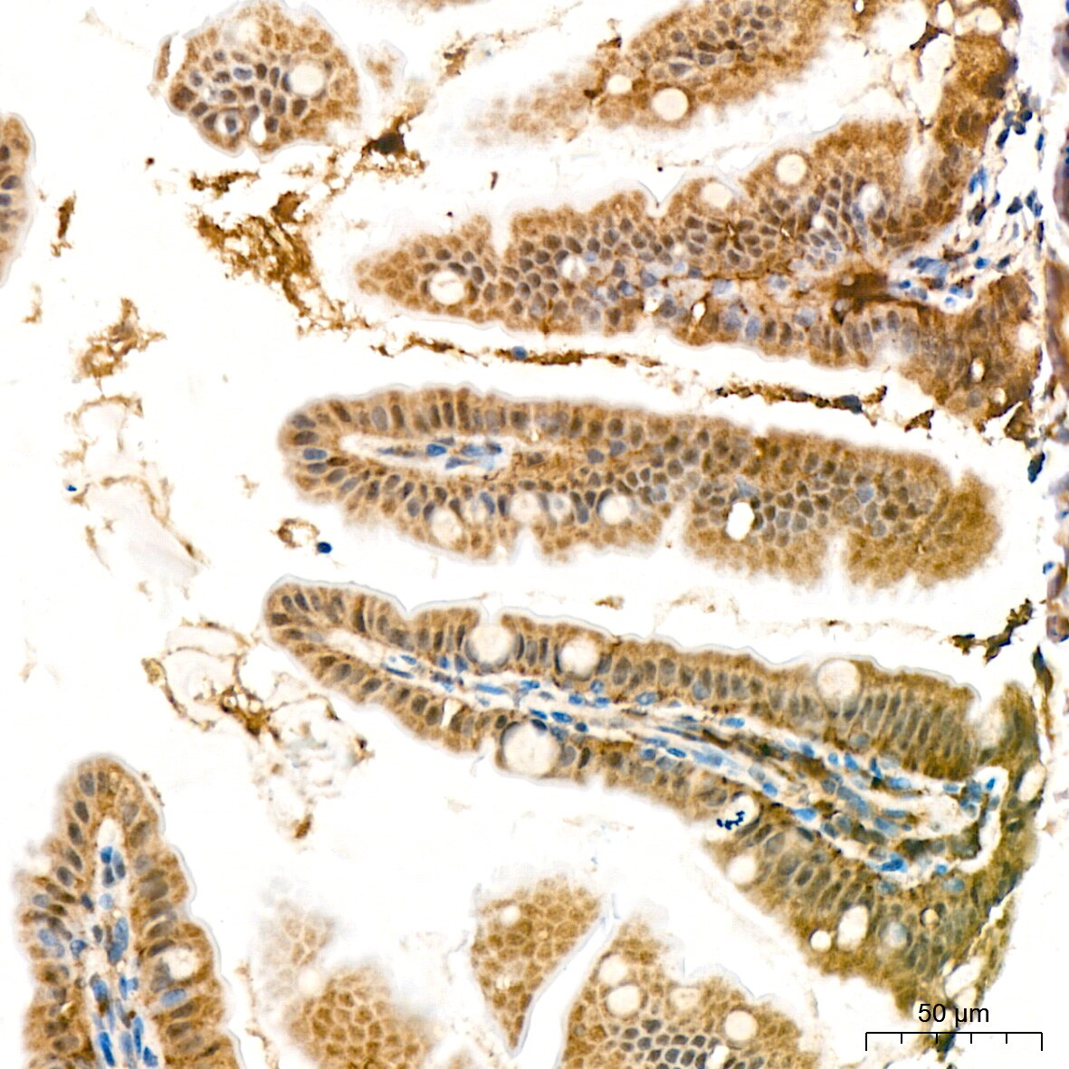 PSMD14 Antibody (5V0H3)