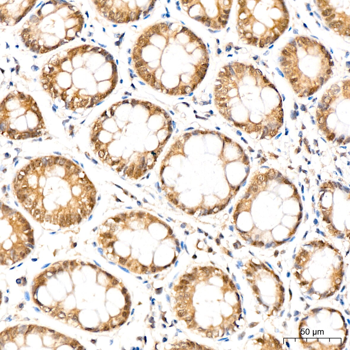 PSMD14 Antibody (5V0H3)