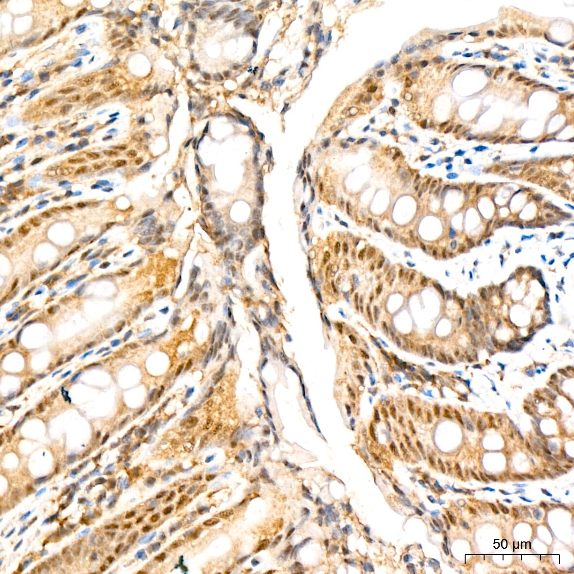 PSMD14 Antibody (5V0H3)