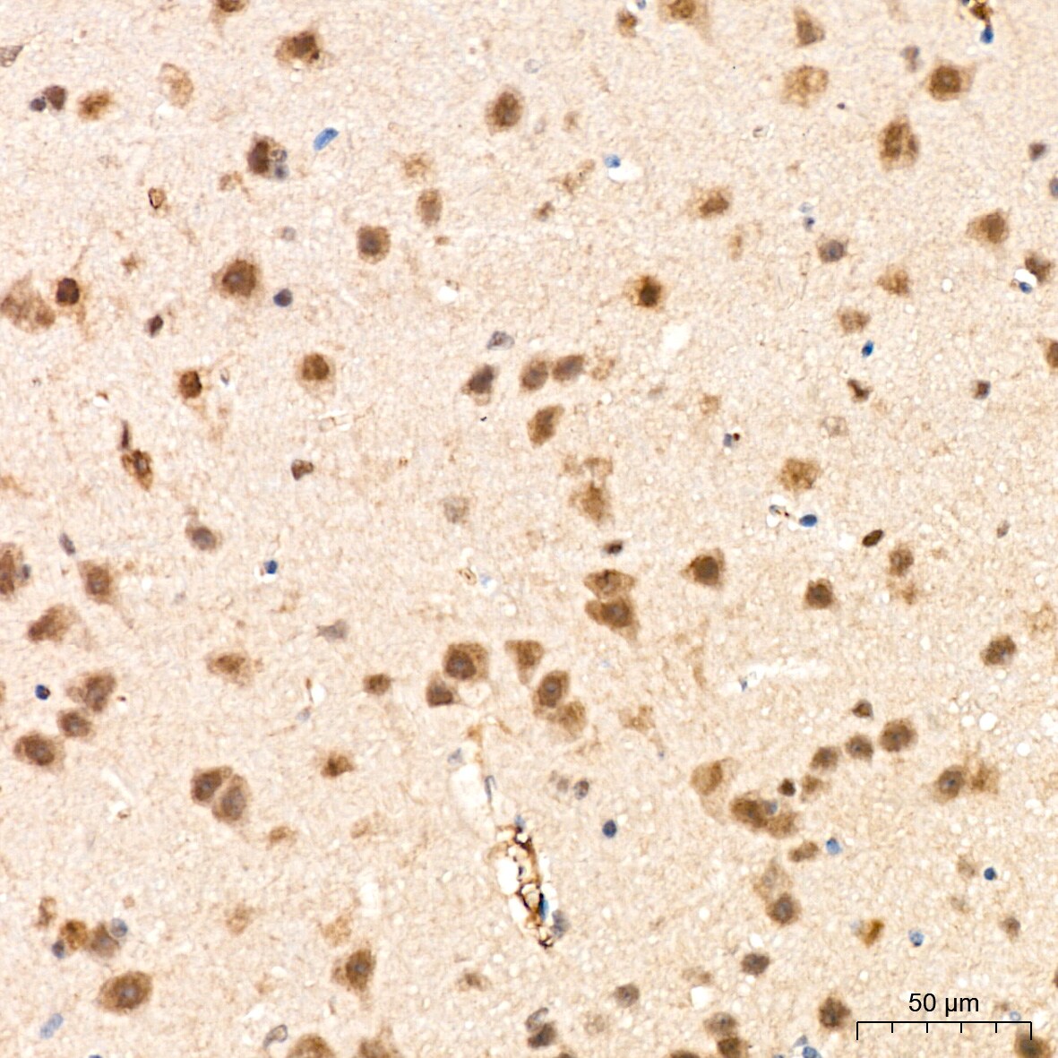 PSMD14 Antibody (5V0H3)