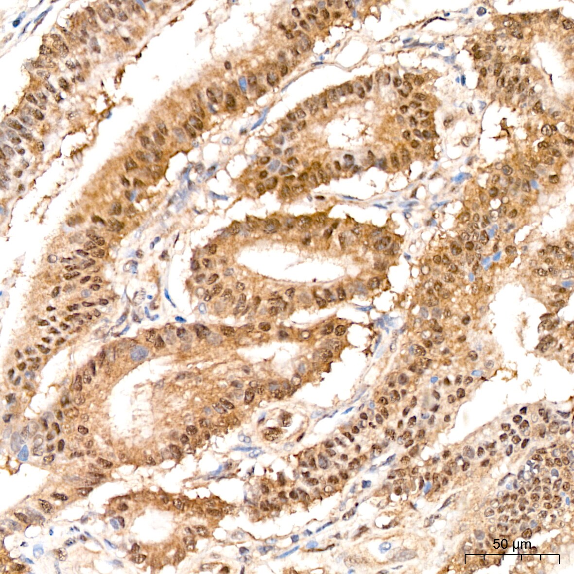 PSMD14 Antibody (5V0H3)