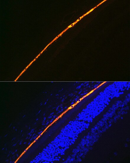 RPE65 Antibody (5X1F6)