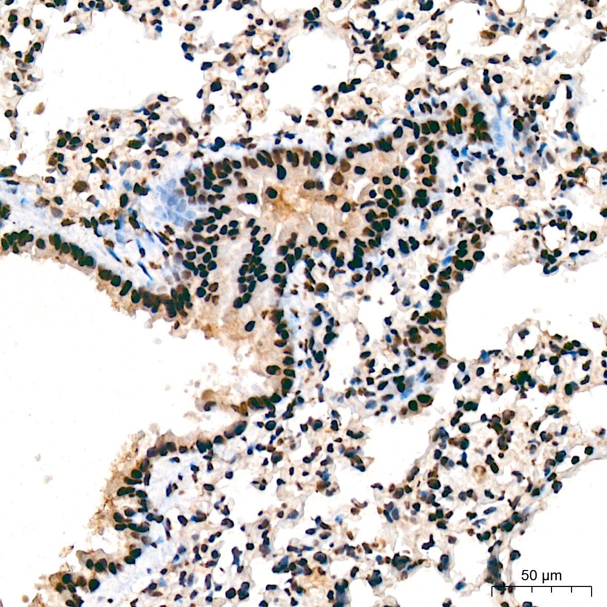 SAP130 Antibody (3K1X4)