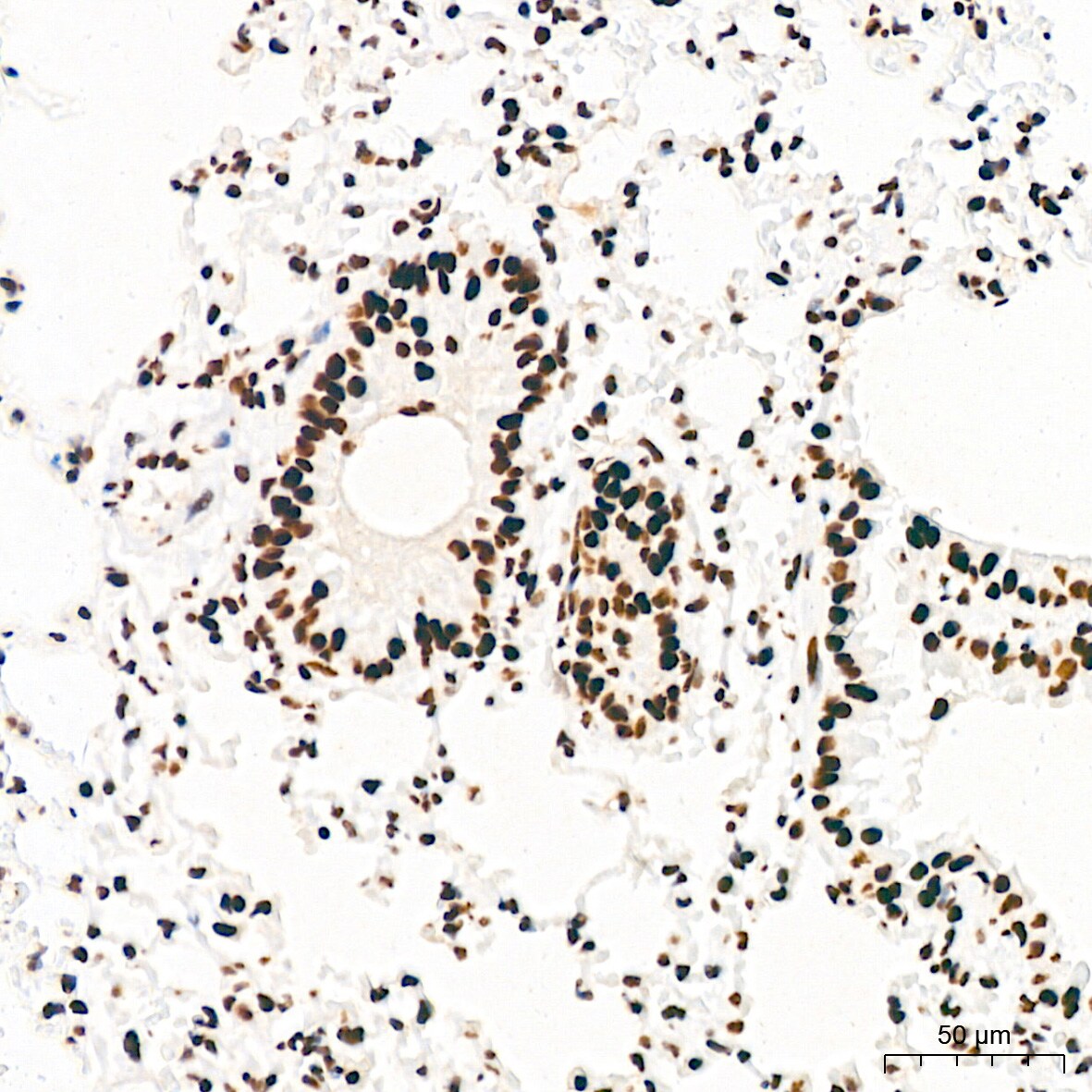 EWSR1 Antibody (9G3H1)