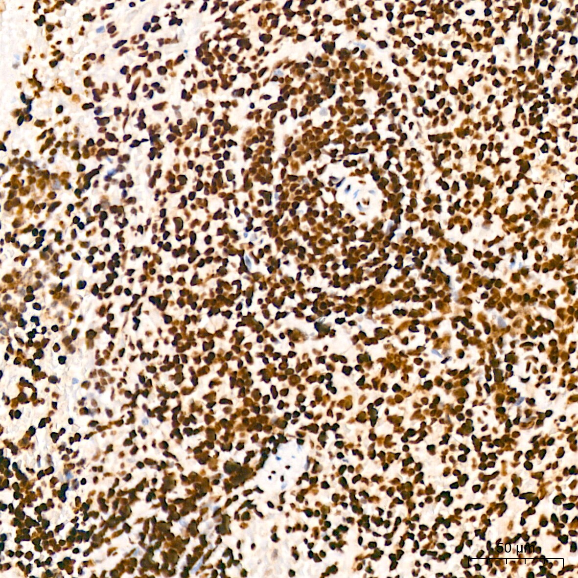EWSR1 Antibody (9G3H1)