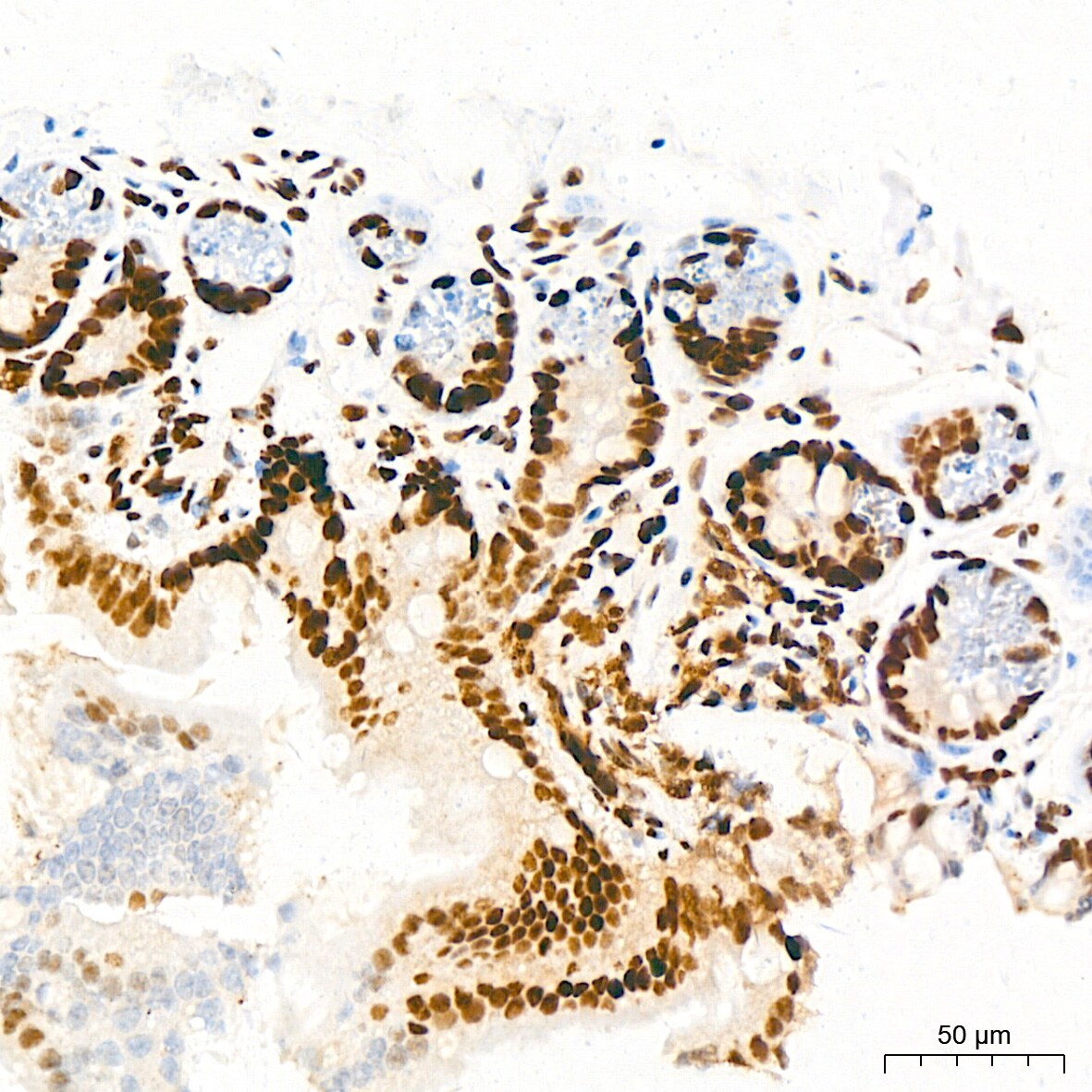 EWSR1 Antibody (9G3H1)