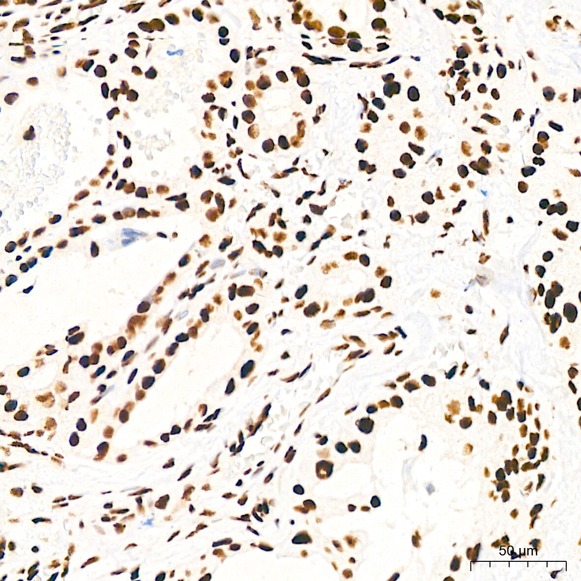 EWSR1 Antibody (9G3H1)