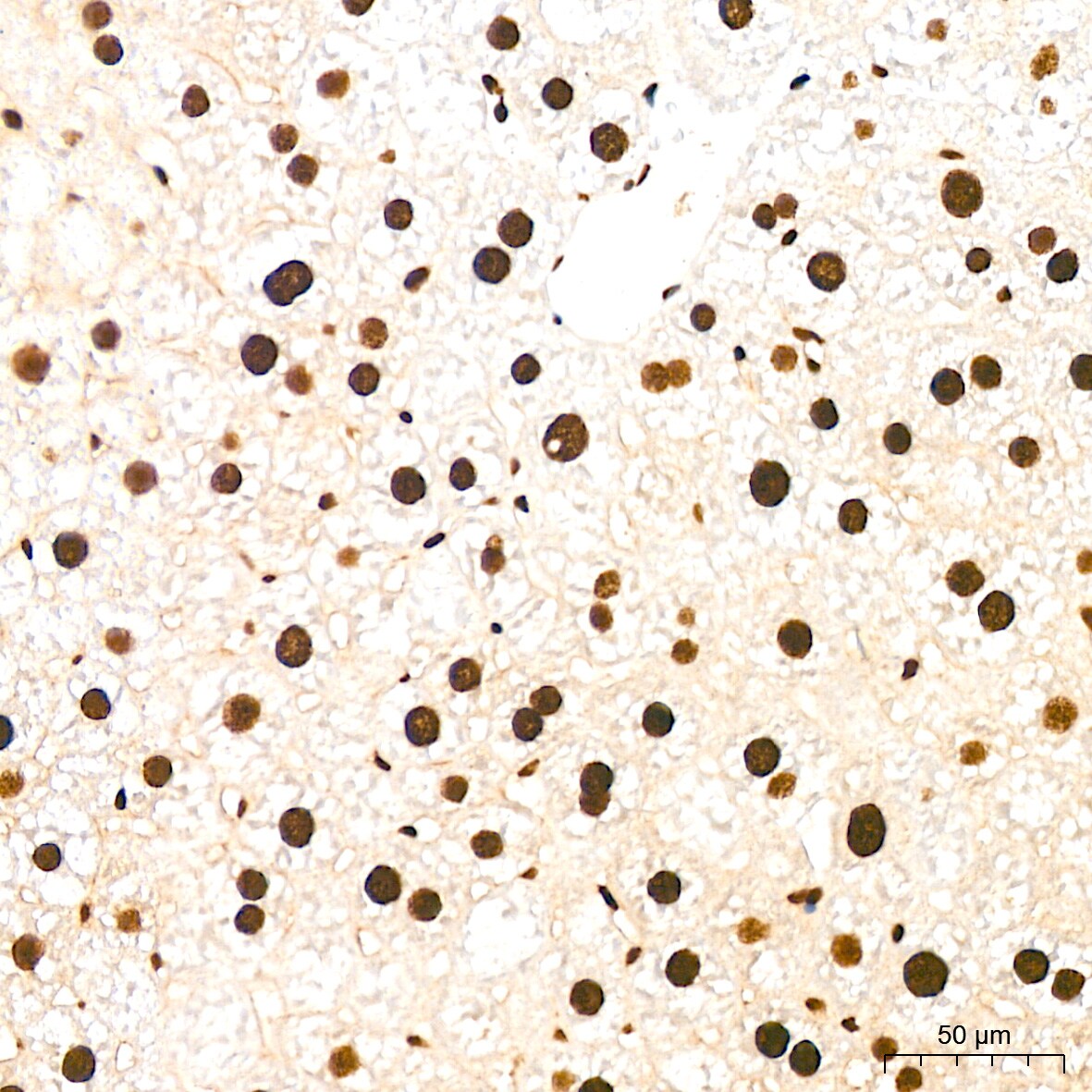 EWSR1 Antibody (9G3H1)
