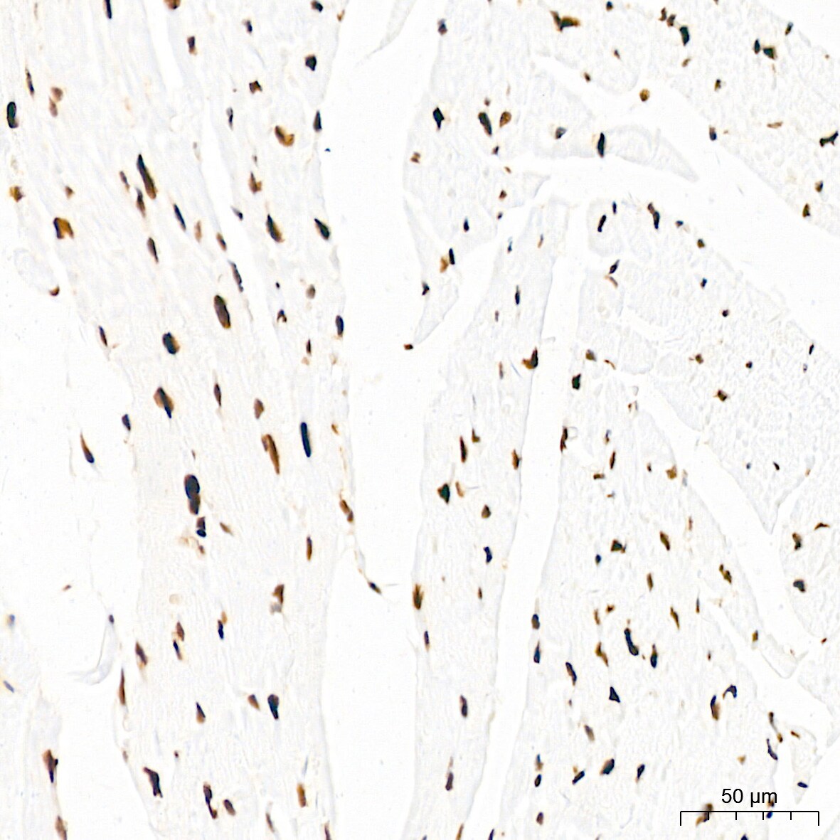 EWSR1 Antibody (9G3H1)