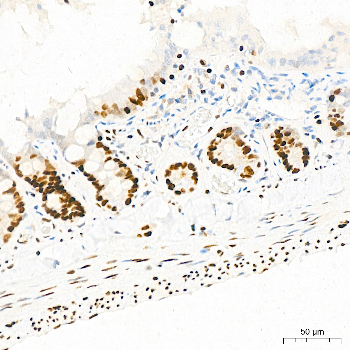 EWSR1 Antibody (9G3H1)