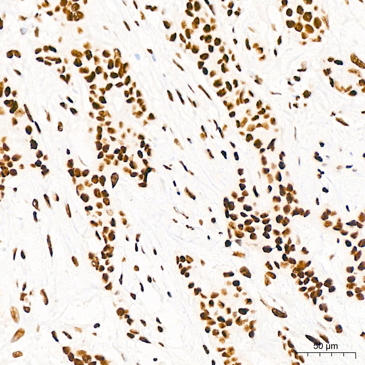 EWSR1 Antibody (9G3H1)