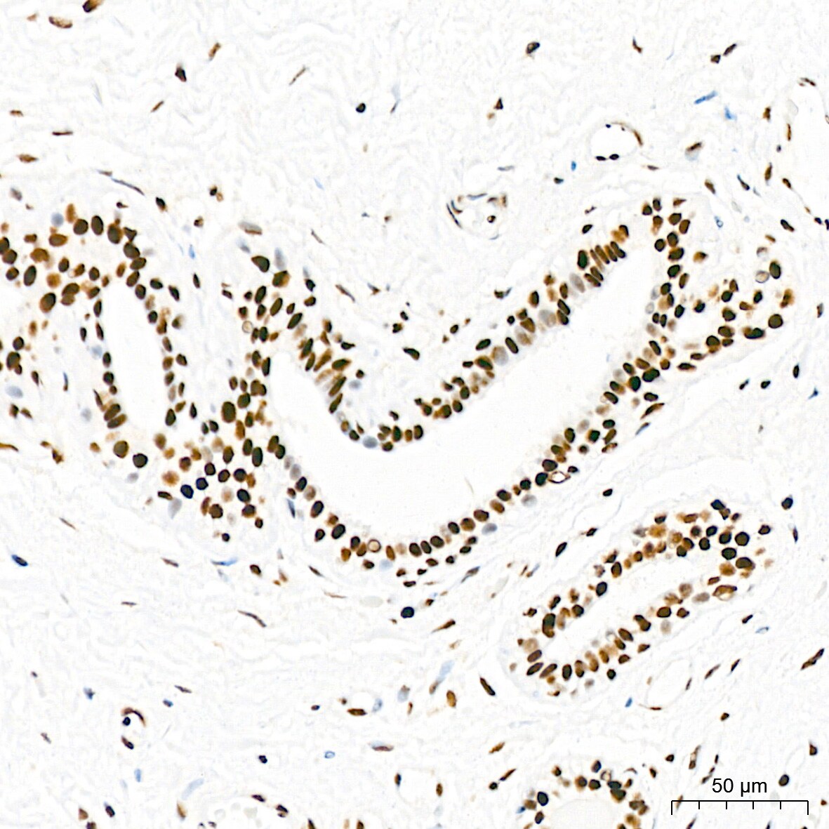 EWSR1 Antibody (9G3H1)