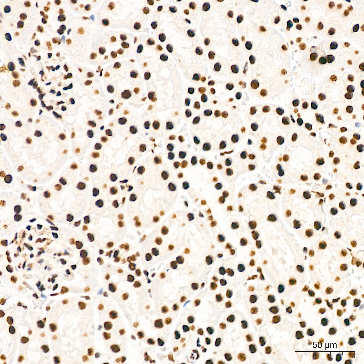 EWSR1 Antibody (9G3H1)